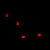 Anti-HDGF Antibody