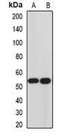 Hemojuvelin Rabbit Polyclonal Antibody