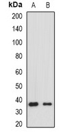 HLA-DRA Rabbit Polyclonal Antibody