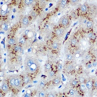 Anti-HO-1 Antibody