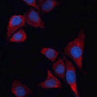 Anti-HO-1 Antibody