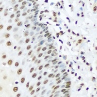 Anti-hnRNP R Antibody