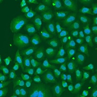 Anti-hnRNP R Antibody