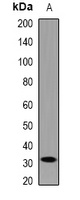 HOXB1 Rabbit Polyclonal Antibody
