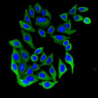Anti-Heparanase Antibody