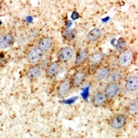 Anti-HSD17B2 Antibody