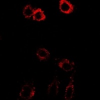 HSD17B2 antibody
