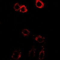 Anti-HSD17B2 Antibody