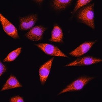 Anti-HSPA2 Antibody
