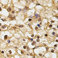 Anti-HUS1 Antibody