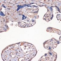 Anti-IGF2 Antibody