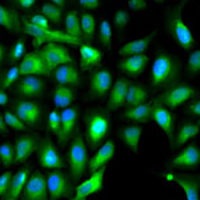 Anti-IGF2 Antibody