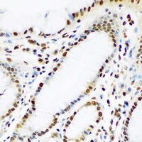 Anti-IGF2BP1 Antibody
