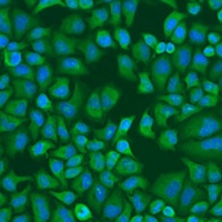 Anti-IGF2BP1 Antibody