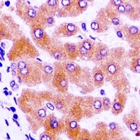 Anti-IGFBP4 Antibody