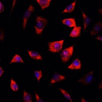 Anti-IGFBP4 Antibody