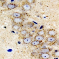 Anti-IGFBP5 Antibody