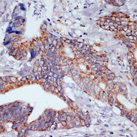 Anti-IKK epsilon Antibody