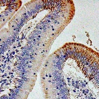 Anti-CD212 Antibody