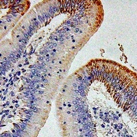 IL12RB1 antibody