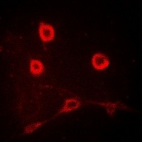 Anti-CD212 Antibody