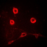 IL12RB1 antibody