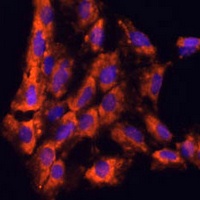 Anti-IL-18 Antibody