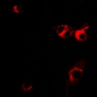 Anti-IL-1RA Antibody