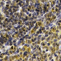 Anti-IL-21 Antibody