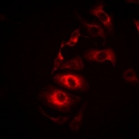 Anti-IL-21 Antibody