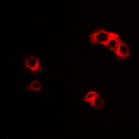 Anti-IL-23R Antibody