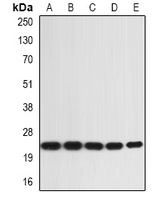 IL-36A Rabbit Polyclonal Antibody