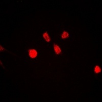 Anti-ING5 Antibody