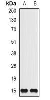 ISG15 Rabbit Polyclonal Antibody