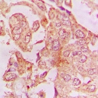 Anti-ISG15 Antibody