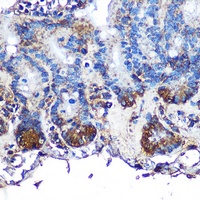 Anti-Omentin Antibody