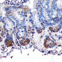 ITLN1 antibody