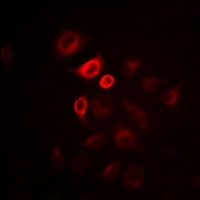 Anti-Omentin Antibody