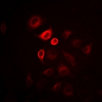 ITLN1 antibody