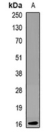 KCNE1 Antibody