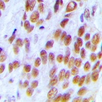 Anti-KDM1A Antibody