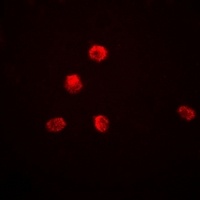 Anti-KDM1A Antibody