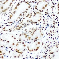 Anti-KLF4 Antibody