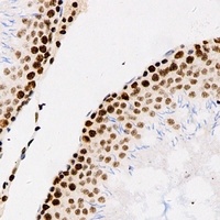 Anti-Importin alpha 1 Antibody