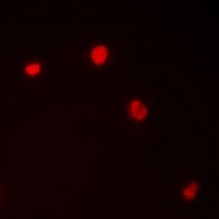 Anti-Importin alpha 1 Antibody