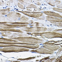 Anti-ZASP Antibody