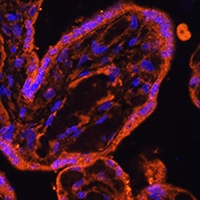 Anti-ZASP Antibody