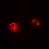 Anti-LDHA Antibody