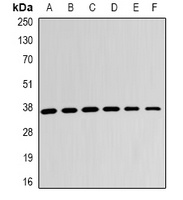 LDHB Antibody