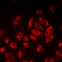 Anti-LITAF Antibody